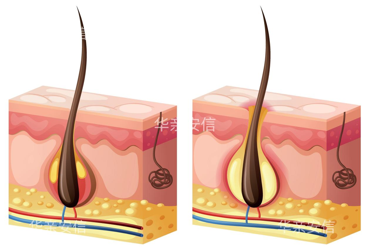头发做亲子鉴定靠谱吗?关键看毛囊!